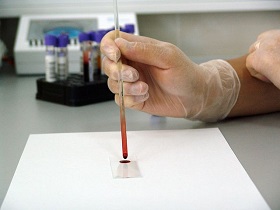 Testing of blood