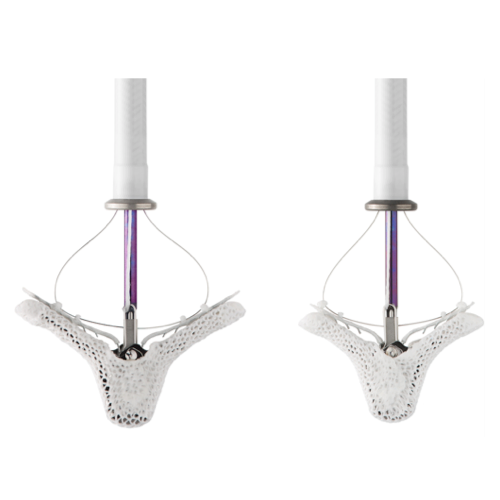 mitraclip-ntr-xtr-500×500-1