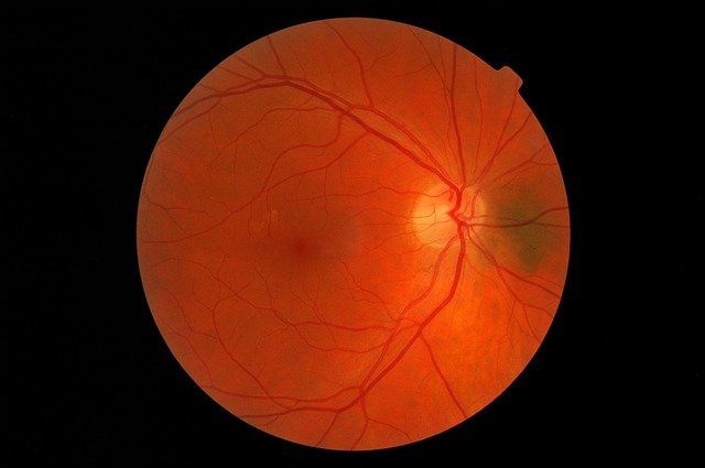 Retina from Pixabay