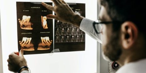 Dentist-looking-at-Xrays