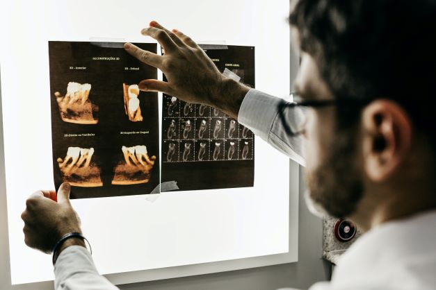 Dentist-looking-at-Xrays