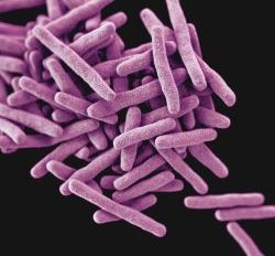 TB Bacteria