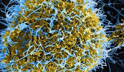 filamentous-ebolavirus-particles-scanning-electron-micrograph-cell.jpg (JPEG Image 1600 × 1380 pixels) — Scaled (32%)