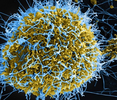filamentous-ebolavirus-particles-scanning-electron-micrograph-cell.jpg (JPEG Image 1600 × 1380 pixels) — Scaled (32%)
